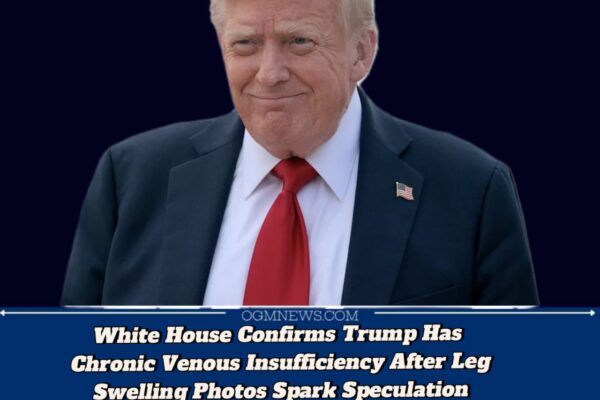 Trump Diagnosed with Common Vein Condition, White House Says Health Remains Excellent