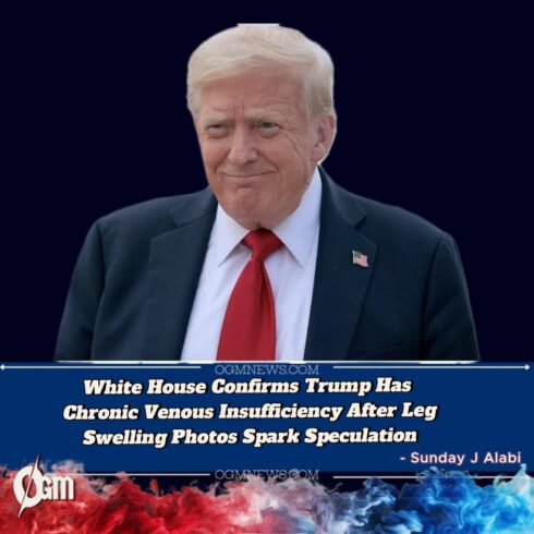 Trump Diagnosed with Common Vein Condition, White House Says Health Remains Excellent