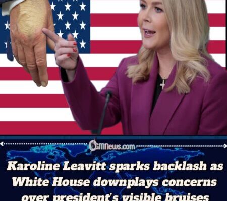 White House Press Secretary Karoline Leavitt dismisses health rumors, says president’s bruised hand only from handshakes