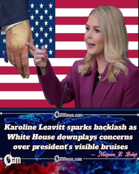 White House Press Secretary Karoline Leavitt dismisses health rumors, says president’s bruised hand only from handshakes