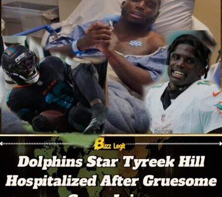 Tyreek Hill Dislocates Knee in Dolphins’ Clash with Jets, Surgery Looms