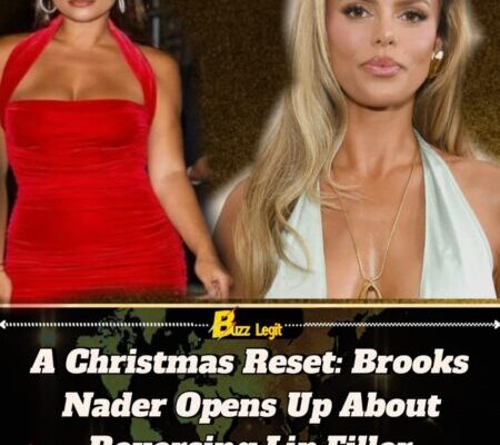 Brooks Nader Reverses Lip Filler Ahead of Christmas, Calls It a Gift to Her Parents