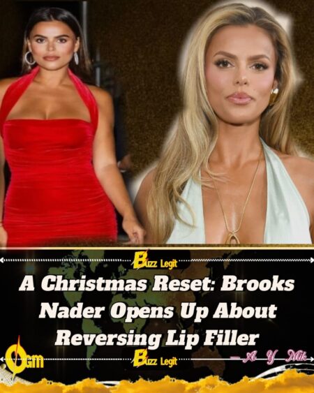 Brooks Nader Reverses Lip Filler Ahead of Christmas, Calls It a Gift to Her Parents
