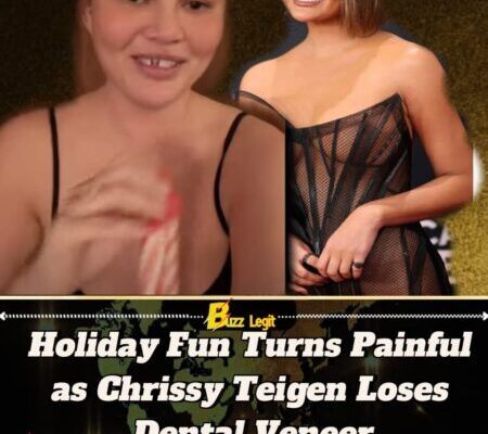 Chrissy Teigen Loses Front Tooth During Christmas Activity With Her Children