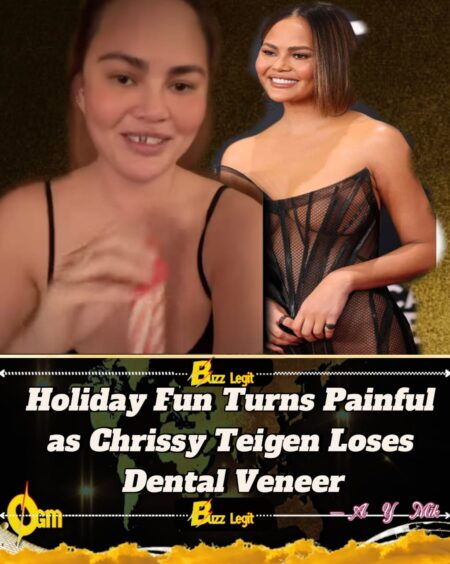 Chrissy Teigen Loses Front Tooth During Christmas Activity With Her Children