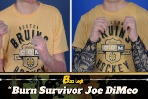 TikToker Joe DiMeo Shares Journey After Historic Face Transplant