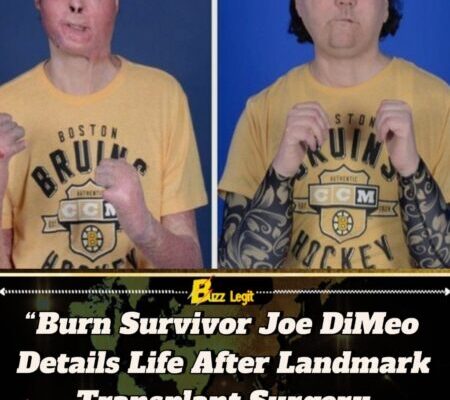 TikToker Joe DiMeo Shares Journey After Historic Face Transplant Following Devastating Car Crash