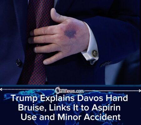 Trump Explains Davos Bruise, Downplays Health Concerns and Floats Idea of Another Term