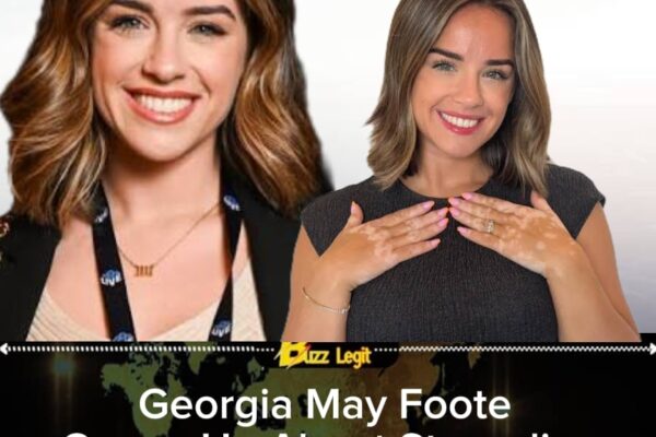 Georgia May Foote Speaks Honestly About Living With Vitiligo