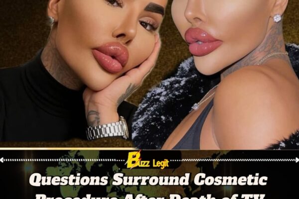 Botched Star Jordan James Parke Dies at 34 After Possible Cosmetic Procedure, Police Probe Underway