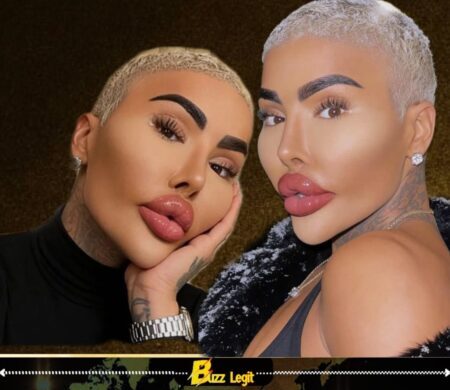 Botched Star Jordan James Parke Dies at 34 After Possible Cosmetic Procedure, Police Probe Underway