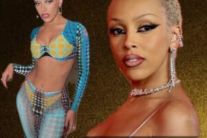 Doja Cat Opens Up About Lipedema Concerns After 2023 Liposuction