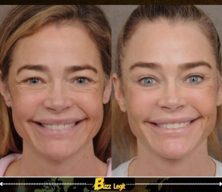 DENISE RICHARDS GIVES HER FACE — AND CONFIDENCE — A LIFT IN CANDID COSMETIC REVEAL