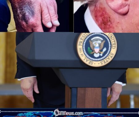 AMERICA IS NOT WELL — VIRAL HAND IMAGES OF PRESIDENT TRUMP SPARK ONLINE HEALTH SPECULATION AND POLITICAL DEBATE