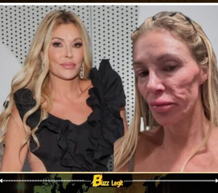 Brandi Glanville’s “Ringworm Scare” Confession Sparks Outrage, Medical Debate, and Internet Chaos