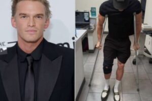 Recovery Chaos Hits Cody Simpson After Double Injury Halts Music Career Momentum
