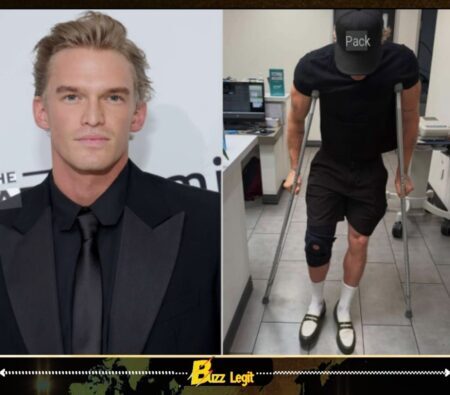 Recovery Chaos Hits Cody Simpson After Double Injury Halts Music Career Momentum