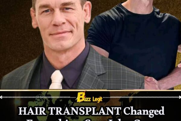 HAIR TRANSPLANT Over Pride: John Cena Says More Than 20 Hours of Surgery 'Totally Changed My Life'