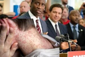 Measles Debate Erupts as Surgeon General Suggests Abortion Opposition May Be Linked to Rising Cases