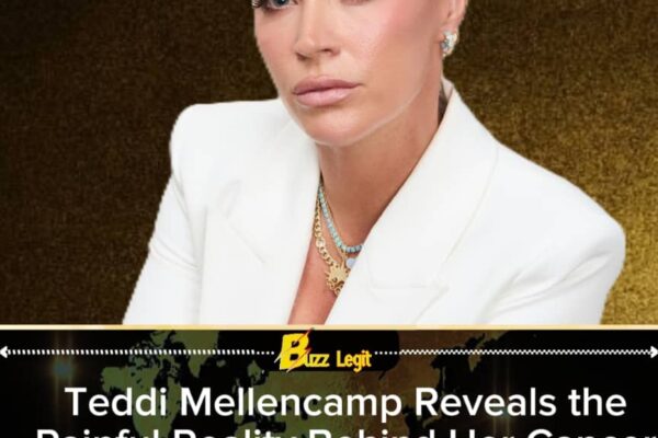 Teddi Mellencamp’s Bruising Immunotherapy Battle: ‘Healing Me Day by Day’ Despite the Pain
