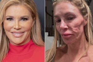 Brandi Glanville’s “Power-Wash” Plan Raises Fresh Questions as Reality Star Faces Another Major Surgery