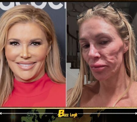 Brandi Glanville’s “Power-Wash” Plan Raises Fresh Questions as Reality Star Faces Another Major Surgery